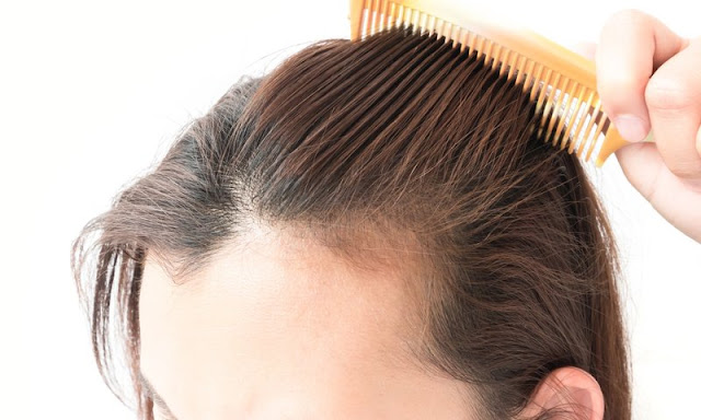 main causes of female hair loss