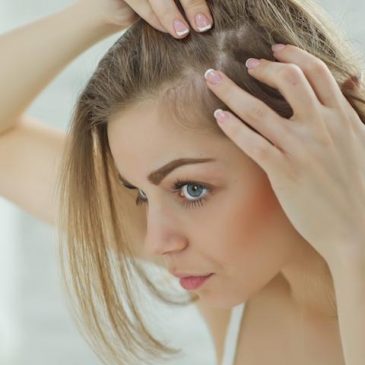 How To Prevent Female Hair Loss