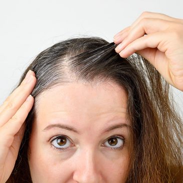 Hair Loss in Women Advice: Common Causes and Solutions