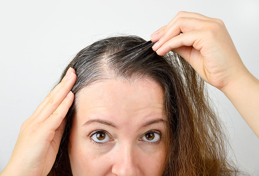 Hair Loss in Women: Common Causes and Solutions 