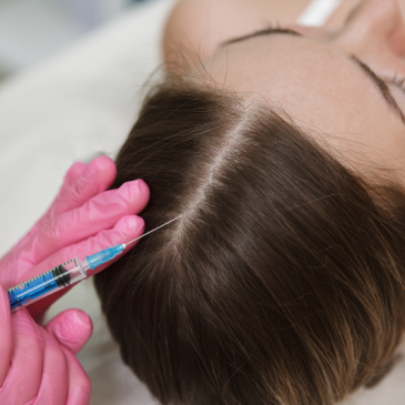 Platelet-Rich Plasma (PRP) Injection Hair Loss Treatment: Does It Work?