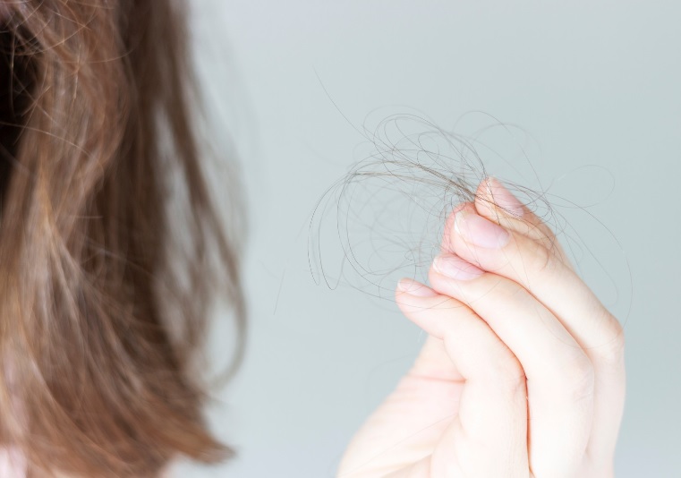 when do women start losing their hair?