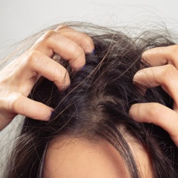 Is Scalp Exfoliation The Key To Stopping Hair Loss?