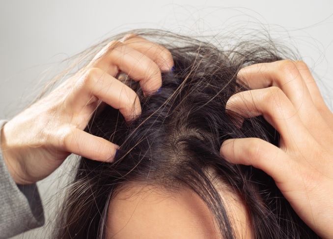scalp exfoliation for hair loss prevention and promotion of hair growth 