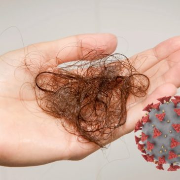 COVID-19 Hair Loss: Causes, Symptoms and Treatment Options