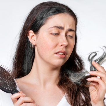 The Worst Things About Losing Your Hair, As a Woman