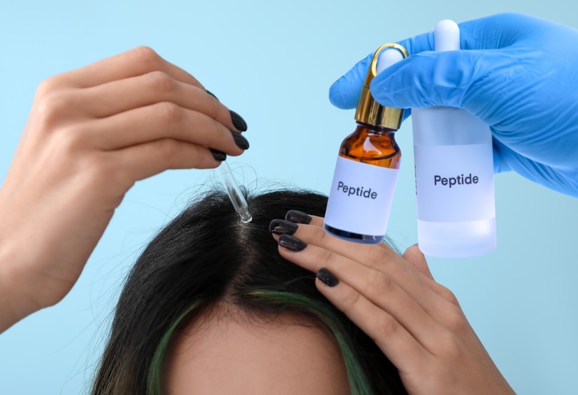 copper peptides for hair loss in women 