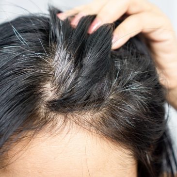 How To Stop Greying of Hair